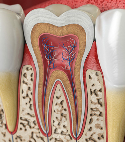 Root Canal Therapy Fort Myers