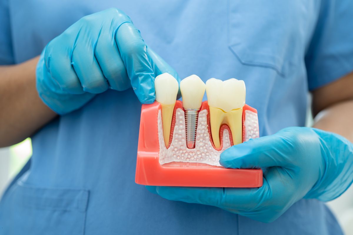 Latest Innovations in Dental Implants: What’s New