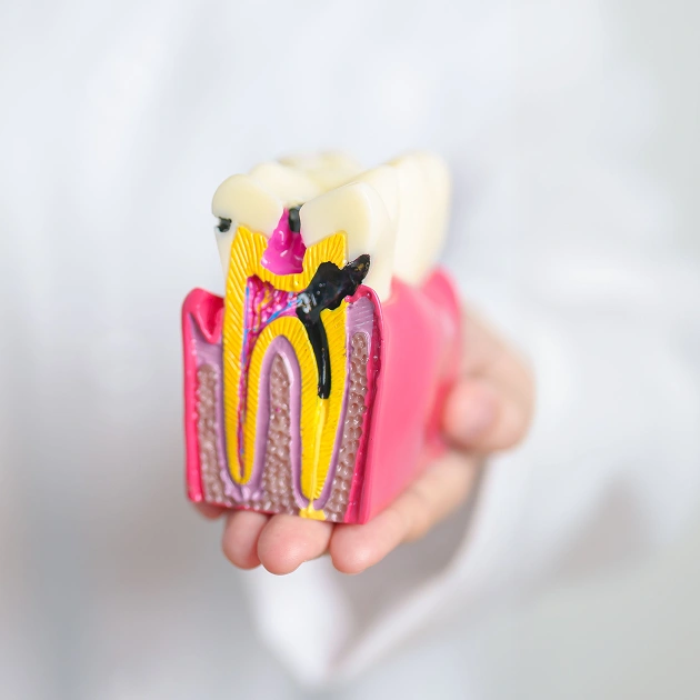 Root Canal Therapy Fort Myers